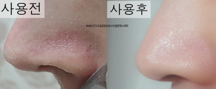  아쿠아필링기 1시 마감 - 워터필링기 대란을 이뤄준 신랑의 코각질 :: 2시 오픈 - 파모나재생선크림&알고덤토너(한정수량20개)