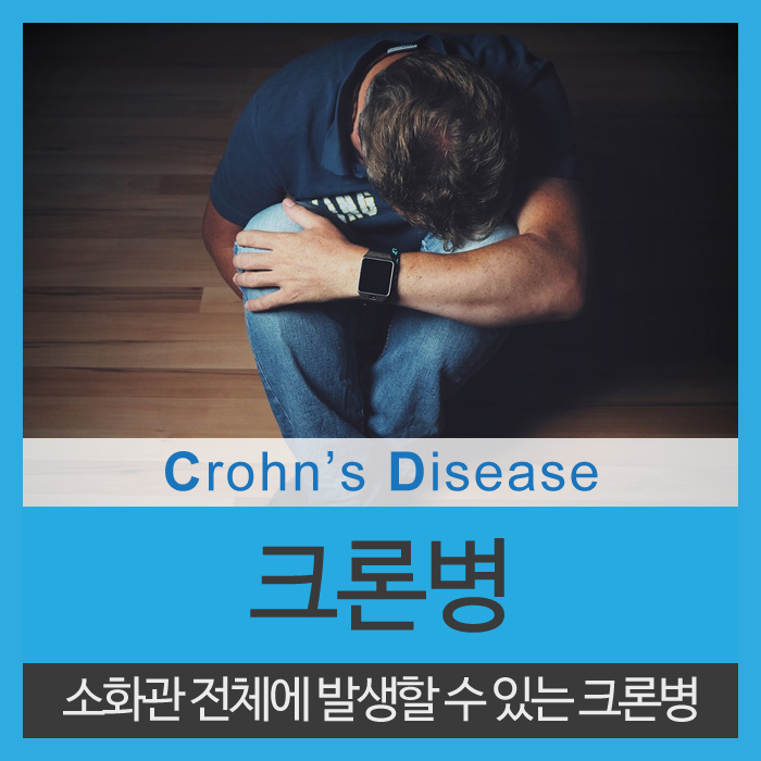  호전과 악화를 반복하는 질환, 크론병의 원인과 예방법