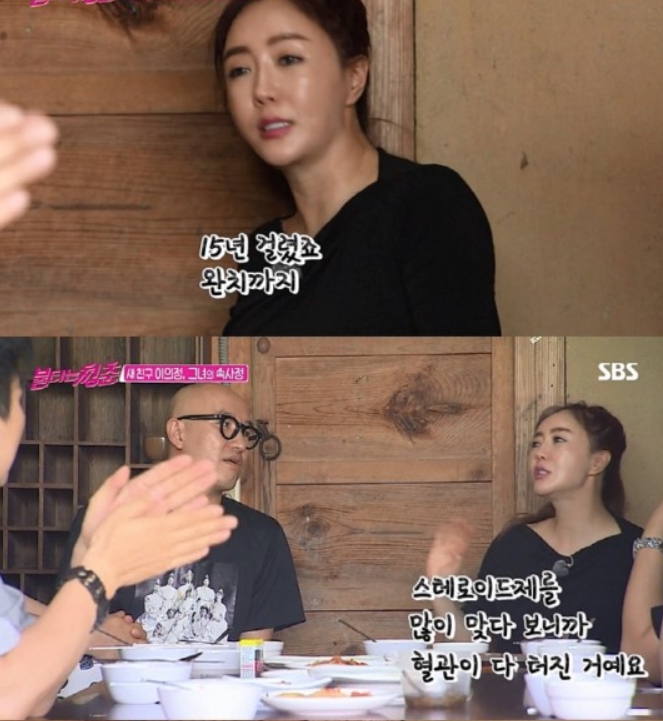  불타는청춘"이의정"출연 암투병,치료까지 털어놔