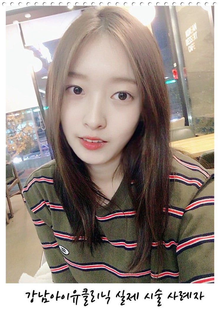  얼굴윤곽주사 예쁘게 해봐요~