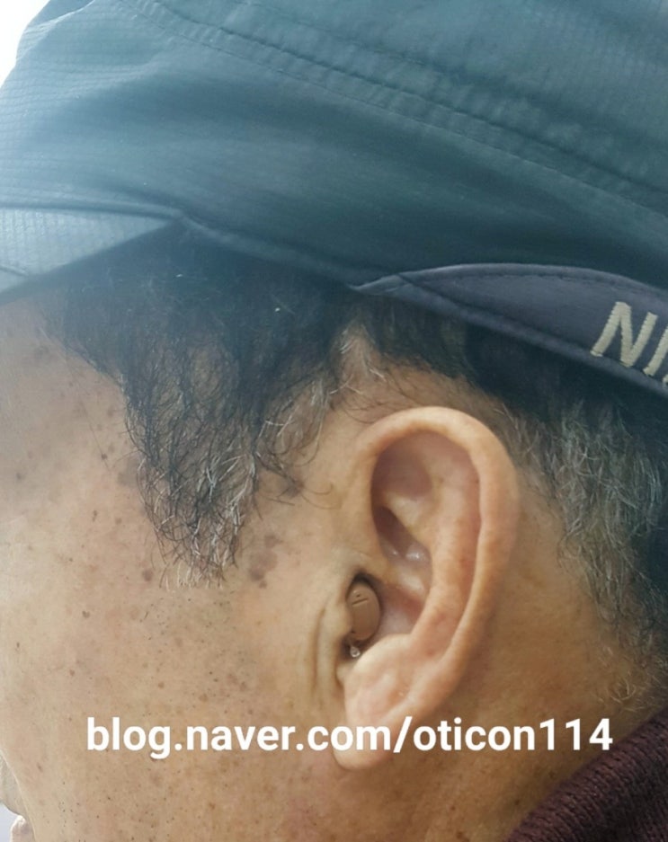 경주보청기/경주난청/귓속형보청기/불국사보청기무료출장/포항오티콘보청기/보청기적응