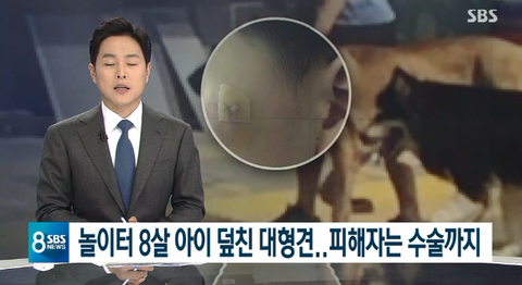  놀이터 8살 아이 덮친 대형견. 피해자는 수술까지.