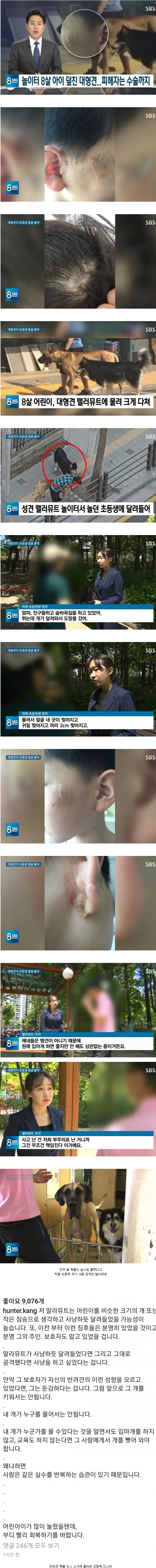  목줄 풀려서 8살 아이 공격한 말라뮤트.jpg