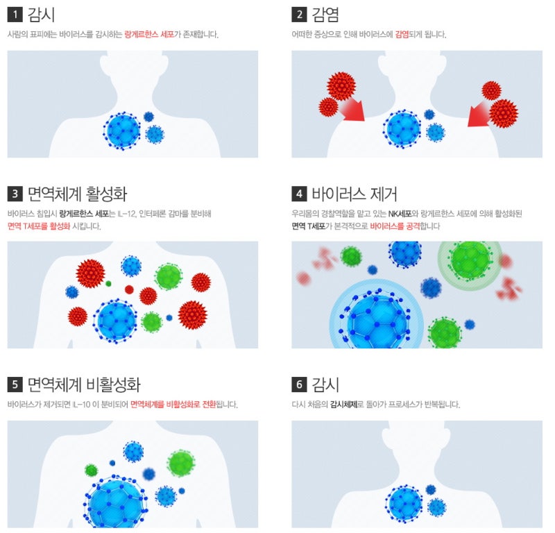 자궁경부이형성증 증상의 근본 원인을 해결하는 면역치료 2