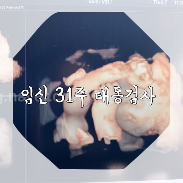  임신 31주 증상 태동검사 경부길이 체크 +인천서구 수돗물 녹물사건 안전하지 않은 우리집