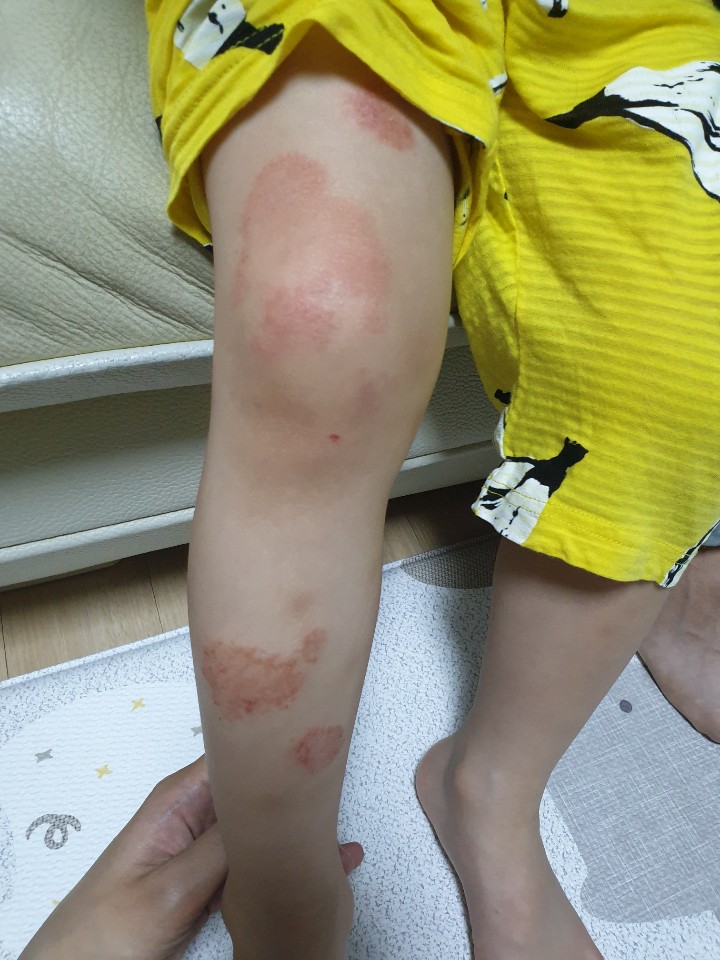  스테로이드 리바운드 길었던 시간 탈스 뒷이야기