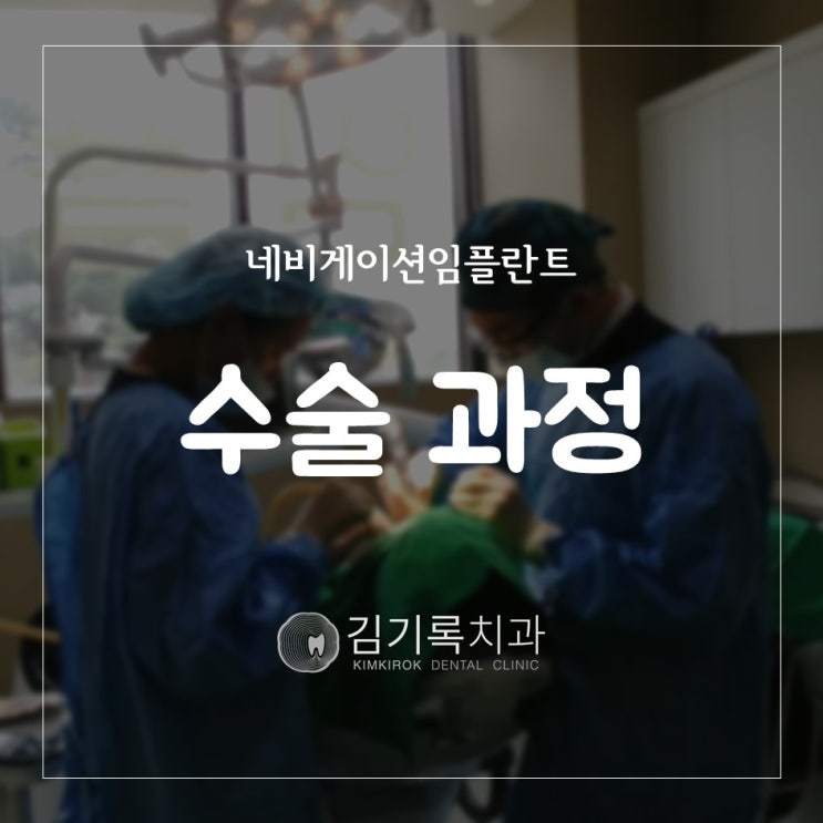 내비게이션임플란트로 전체임플란트를 수원인플란트잘하는치과에서 수술했어요!