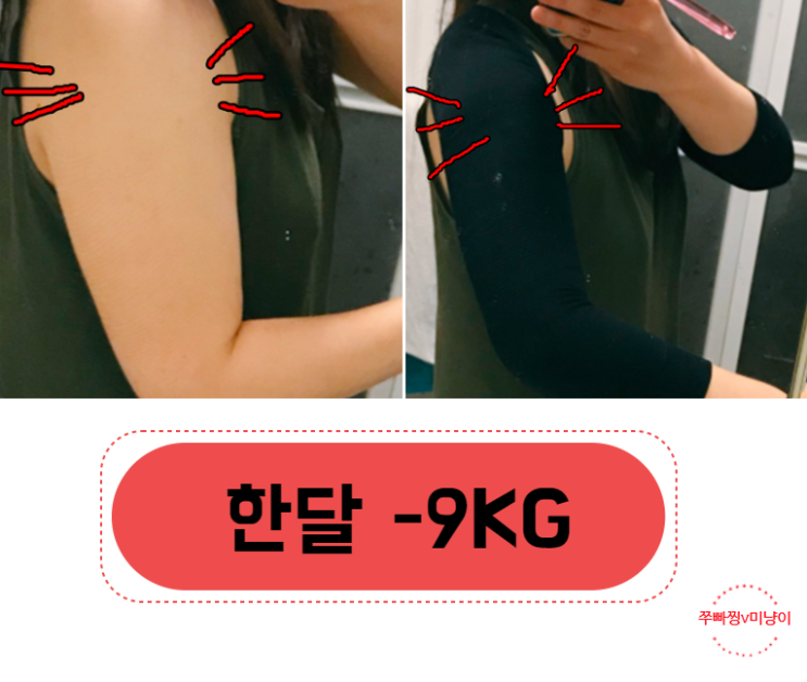  포모라인 L112 부작용 X 한달 -KG 공개!