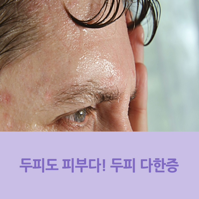  두피도 피부다! 두피 다한증 완화하려면?