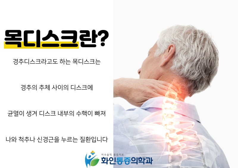 부산도수치료추천 목디스크 병원찾는다면 3
