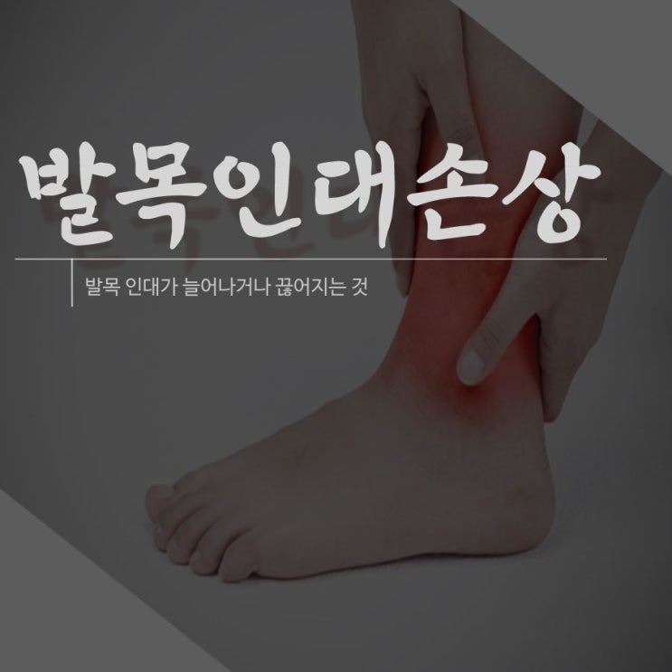  서울대입구역정형외과 발목을 자주 삐끗하시는 분들은 의심해보세요