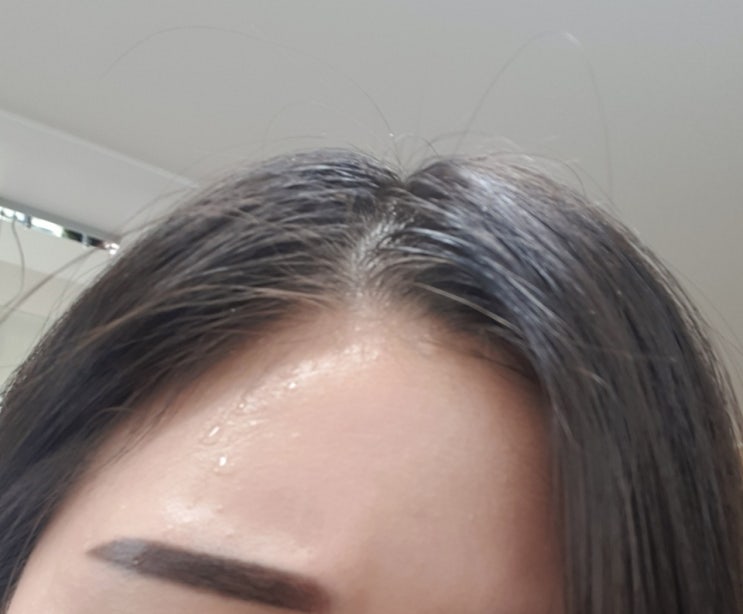  머리열로 인한 머리에 땀 해결법 후기
