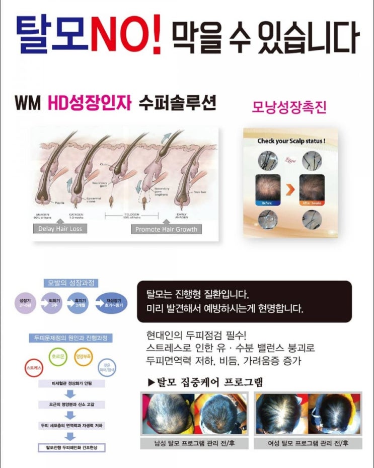  대구를 대표하는 탈모 두피관리 #더블유엠 두피센타