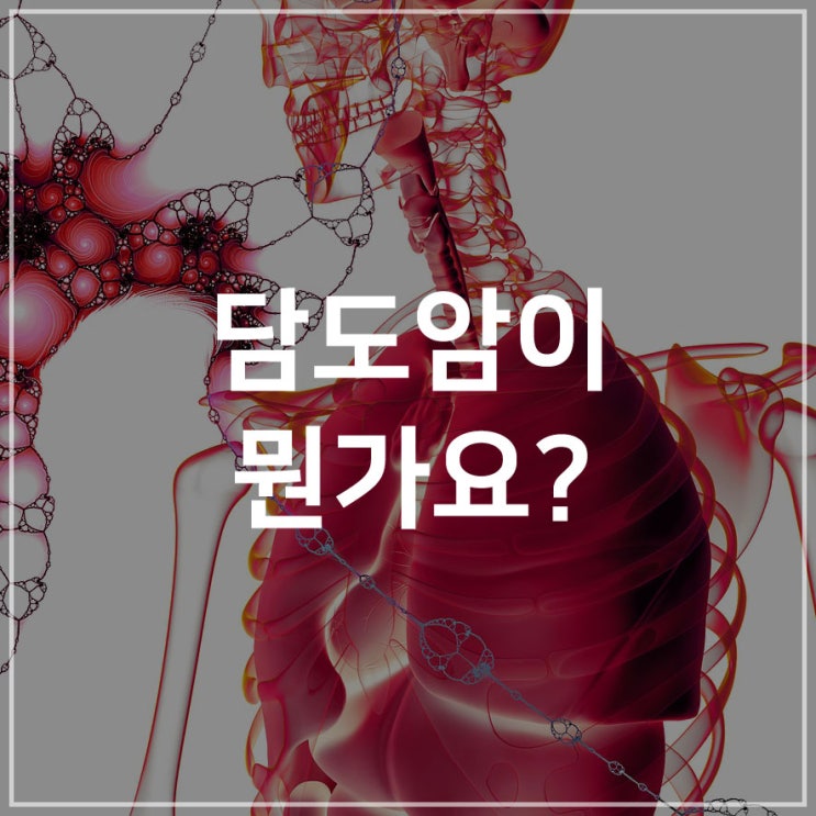  담도암이 뭔가요?