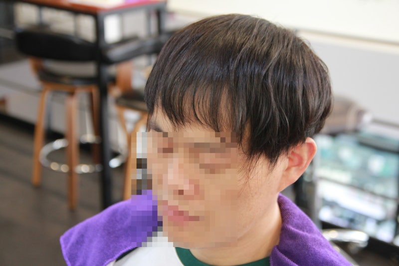 앞머리탈모 고민도 대구증모술 전문 젤리아헤어 남성연장 5