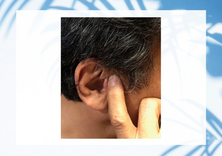  중이염 어지러움, 고름, 난청, 통증 예방법 논문자료