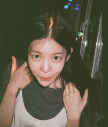  장재인 나이 및 성형전 병 학력 과거 루머 비하인드스토리
