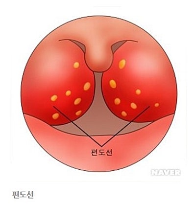 미노신 캡슐 50mg여드름요도감염증 부인과감염중이염 외이도염 유선염 기관지염 편도염 항생제 미노신 효능효과 용법 부작용 주의사항 가격