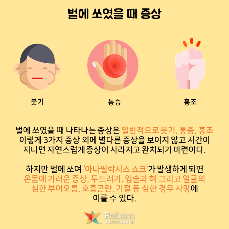 벌에 쏘였을 때 응급처치 방법 미리 알아두세요!