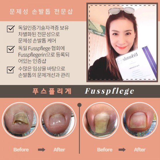 푸스플레게(Fusspflege) 독일연방인증국가기술자격증취득/분당용인수원수지보정동백죽전동/주네일/무좀파고드는발톱전문네일샵 푸스플레게(Fusspflege) 독일연방인증국가기술자격증취득/분당용인수원수지보정동백죽전동/주네일/무좀파고드는발톱전문네일샵