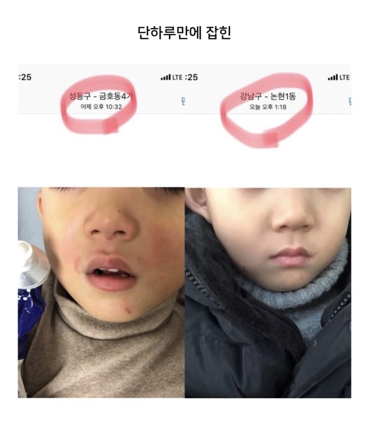 [기적의세트] 아토피/ 건선 / 침독 / 태열 / 건성 / 피부장벽 무너지신분들을 위한 “바이더닥터” 6차 공구 핫딜 OPEN / 세트첫 만원 할인