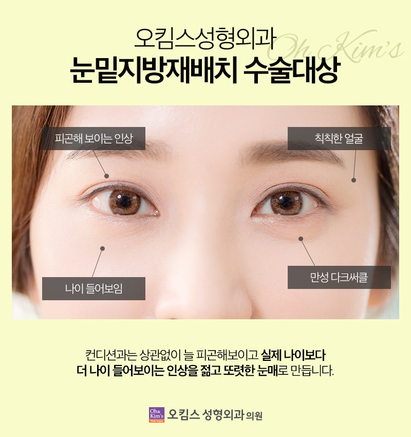 일산오킴스성형외과 1년간 아내의 잔소리를 피할 수 있는 최고의 선물