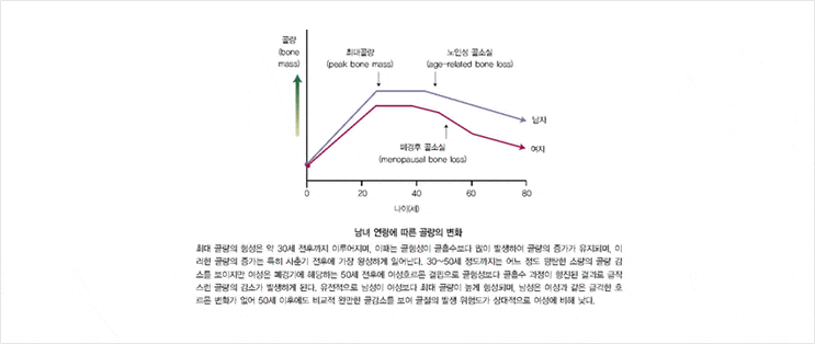  [성남 수진역 신경외과][자유신경외과의원]-골다공증 -주말진료- 365일 언제나 자유신경외과!!