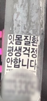  잇몸질환 평생 걱정안합니다???