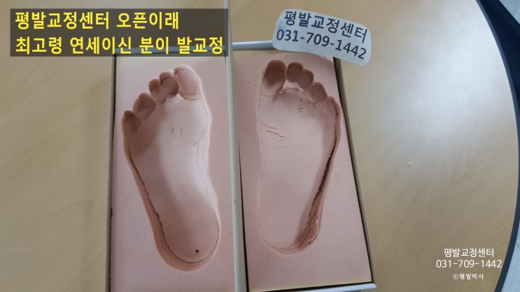  평발교정센터 오픈이래 최고령 연세이신 분이 발 교정하러 오셨네요. - 1944년생이시네요.