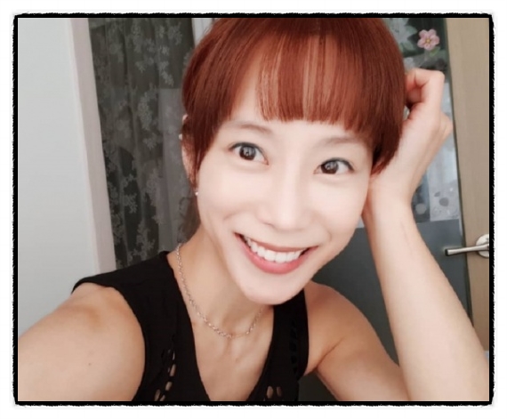  레이노병 투병 고백 쥬얼리 멤버 조민아