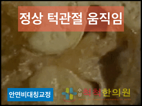  대구안면비대칭 어디서? 턱관절치료병원에서