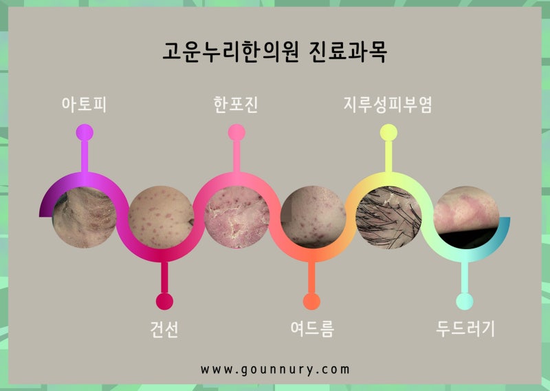 목동한의원 피부를 깨끗하게