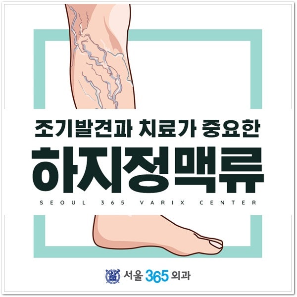 일산하지정맥류 치료 병원 추천 서울365외과