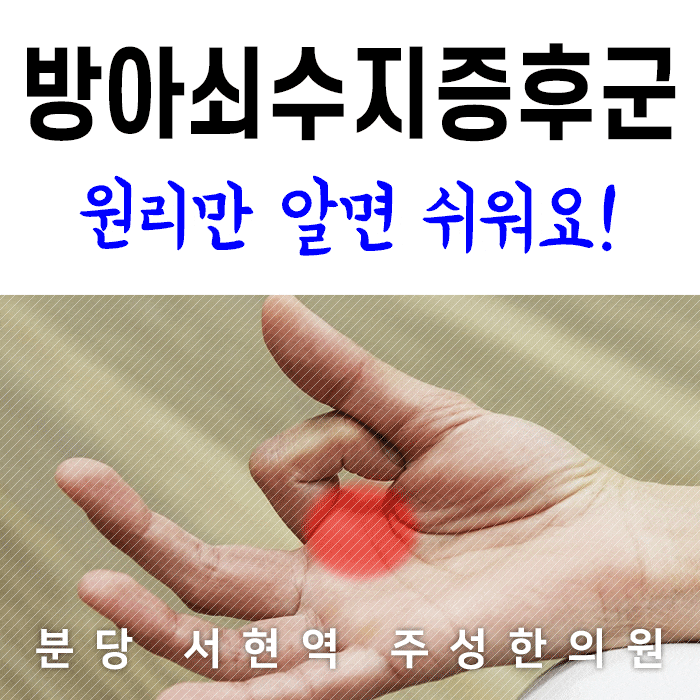 방아쇠수지증후군의 원인은 무엇이며, 예방 및 치료 방법은 무엇입니까?