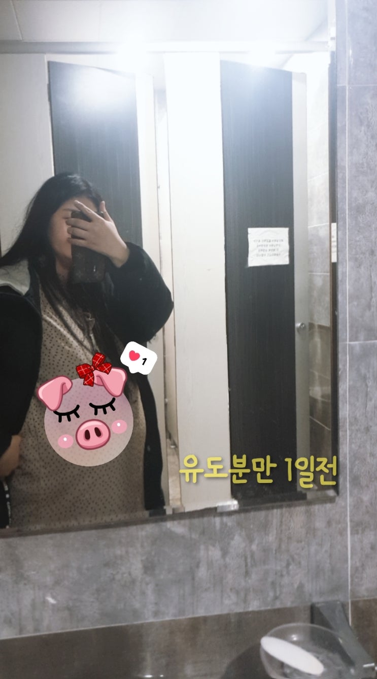  유도분만 성공!