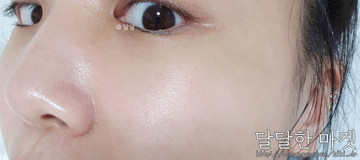  피부관리 #.달달한마켓 : 순하고 확실한 각질제거제로 각질관리 및 피지, 화이트헤드 모공청소! 여드름 극약처방 / 여름날 피부관리 (르본 글리콜락 필링, 훼이셜 아크네 마스크)