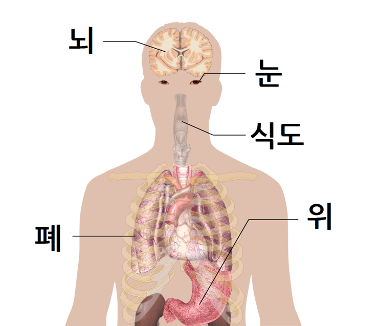  식도암 증상과 원인에 대해 알아봐요