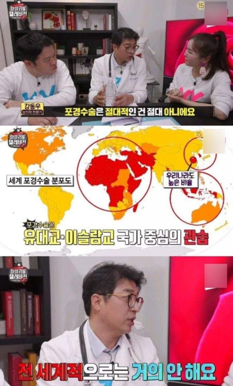  전문가가 말하는 포경수술