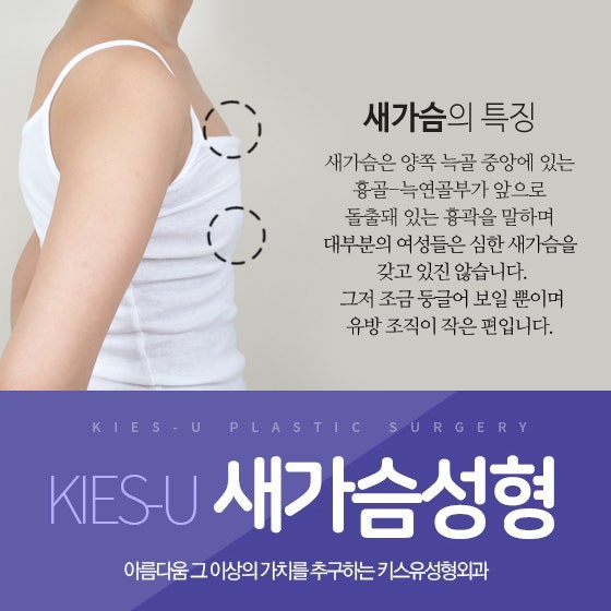 새가슴 가슴성형 키스유성형외과 여자새가슴