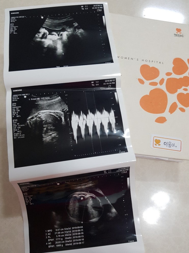  일산 허유재병원 둘째도 신상현교수님께!