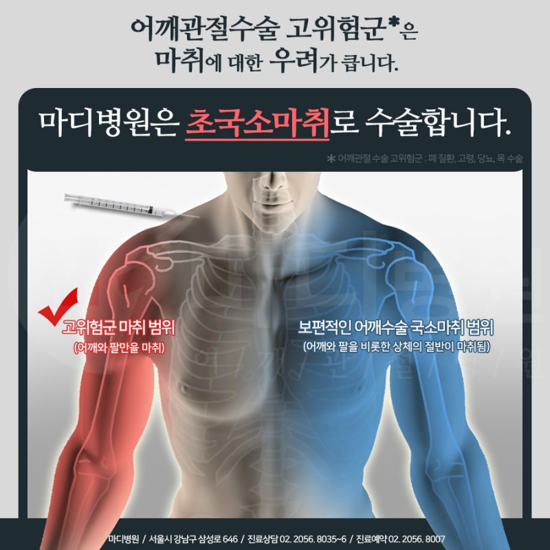 왼쪽어깨통증 원인과 운동 방법 3