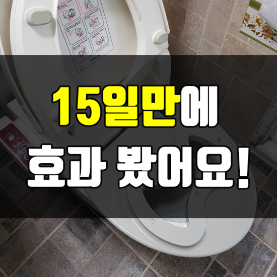 치질증상 빠르게 해결할 수 있었던 이유..!