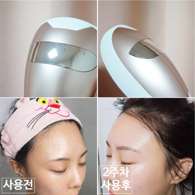  2주차사용 솔직후기) 정인선 퓨리스킨 LED마스크