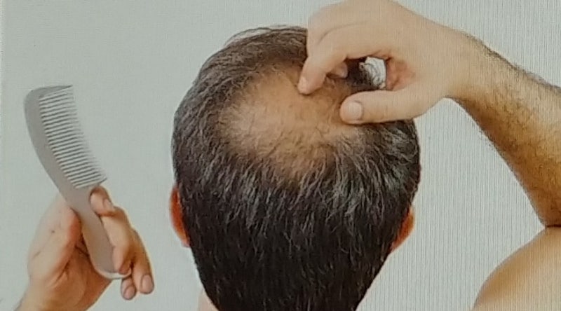머리빠지는꿈 궁금했다면 : 네이버 블로그 머리빠지는꿈 궁금했다면 : 네이버 블로그