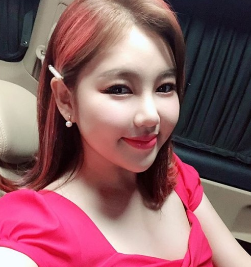  미스트롯’ 송가인, 차량 반파 교통사고 불구 큰부상 없어 <공,펌>