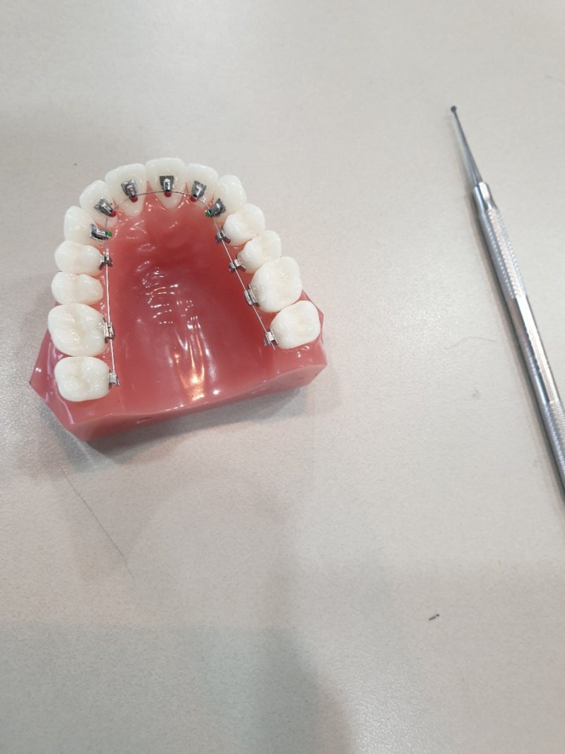 Ormco ALIAS passive lingual bracket 세미나 (앨리어스 설측브라켓) : 네이버 블로그 image.