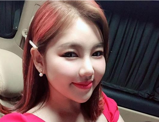  송가인, 20일 새벽 교통사고…"차량 반파, 부상은 경미" 