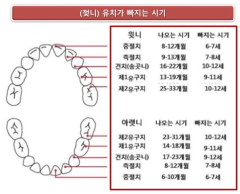 성남 불소도포 제대로 하는 방법 4