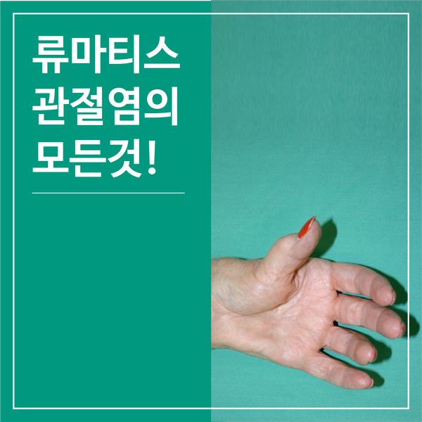  [의료 상식] 류마티스 관절염의 모든 것!