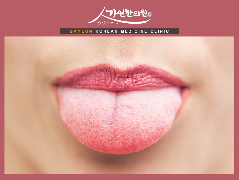 입술 얇아지는법 이렇게 해보세요 : 네이버 블로그 입술 얇아지는법 이렇게 해보세요 : 네이버 블로그